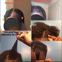 Load image into Gallery viewer, Alopecia Bundle