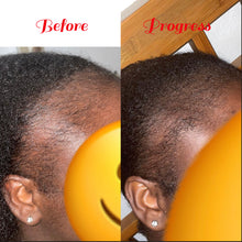 Load image into Gallery viewer, WOW Regrowth Hair Oil