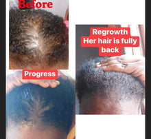 Load image into Gallery viewer, Alopecia Bundle