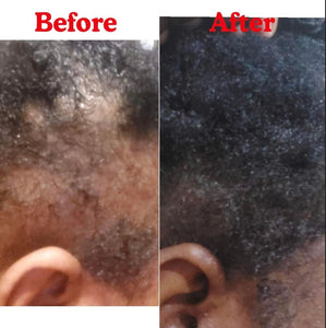 WOW Regrowth Hair Oil