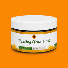 Load image into Gallery viewer, Healing Acne Mask
